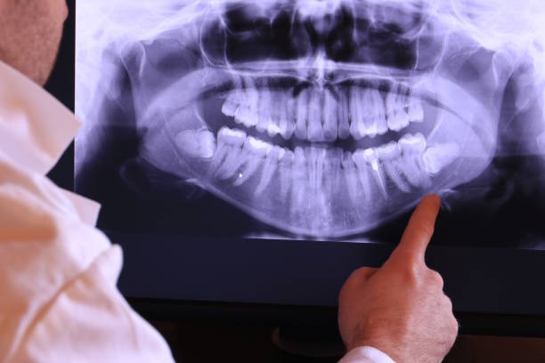 Best Same-Day Emergency Dentist in Morningside, MD