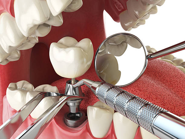 Best Emergency Dental Surgery in Morningside, MD